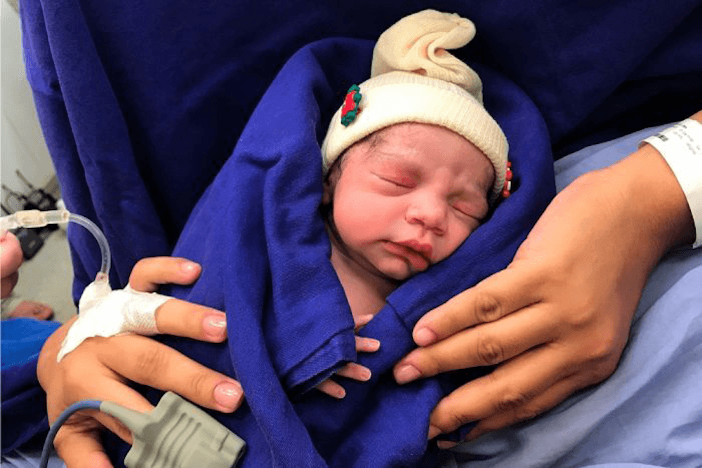 Пересадка матки от умершего донора впервые закончилась рождением ребенка