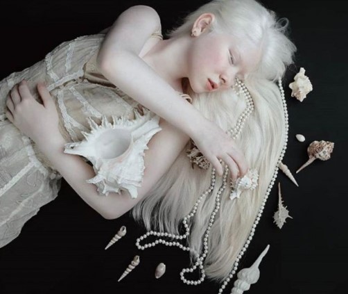 альбиносы