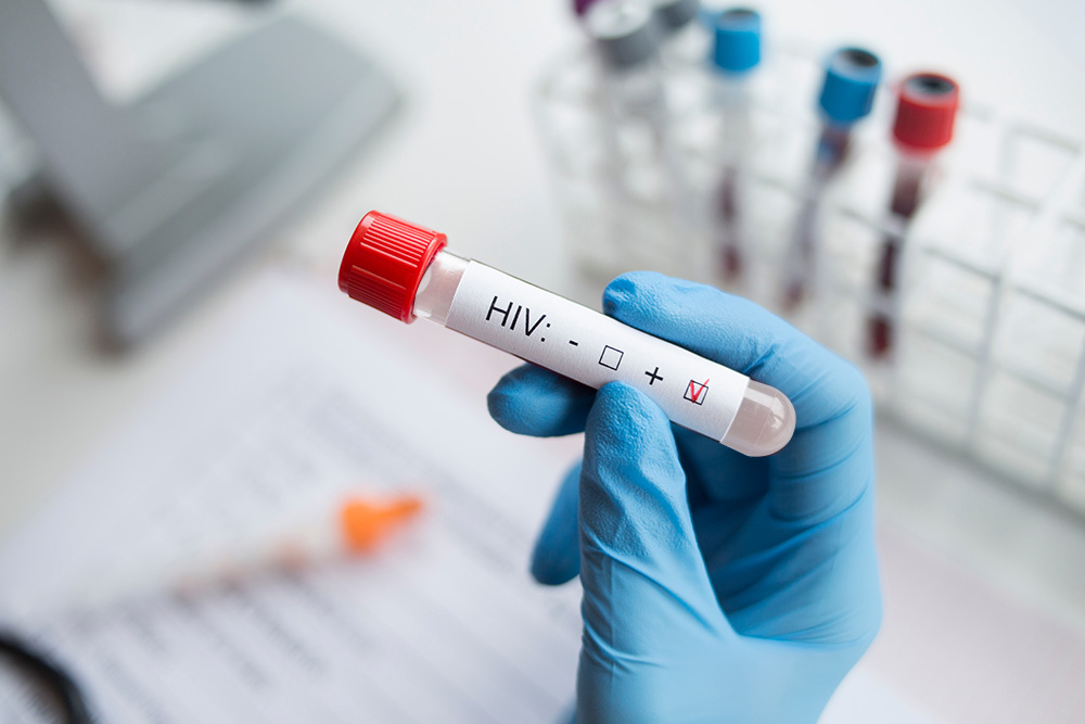 Новая Зеландия открывает первый в мире банк спермы ВИЧ-инфицированных