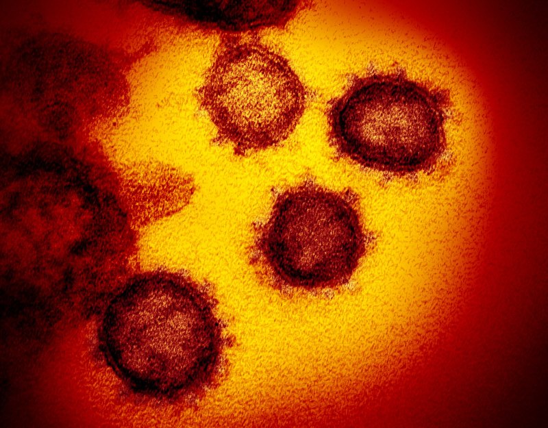  коронавирус под микроскопом