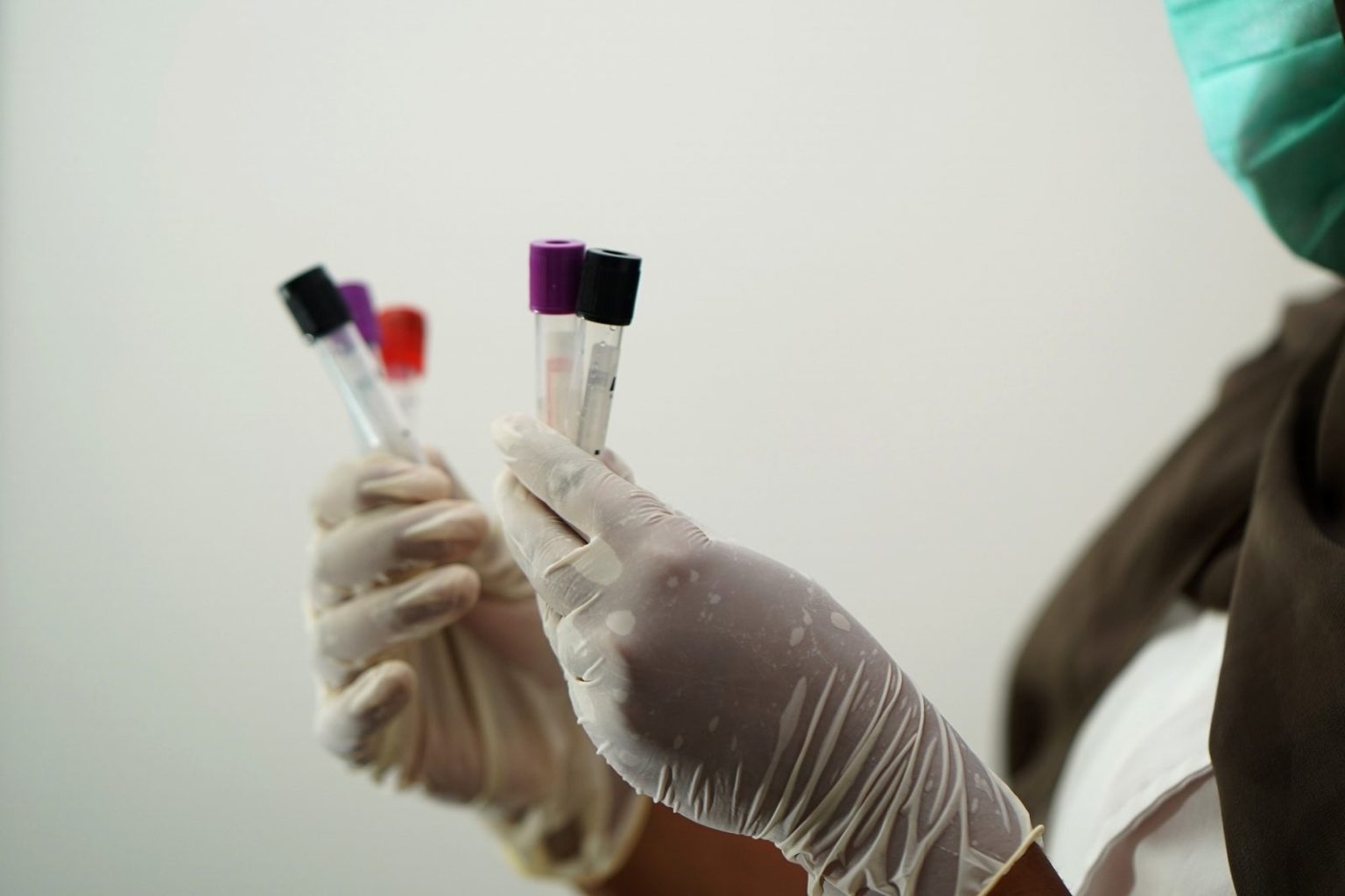 Тесты на антитела к коронавирусу – пустая трата денег