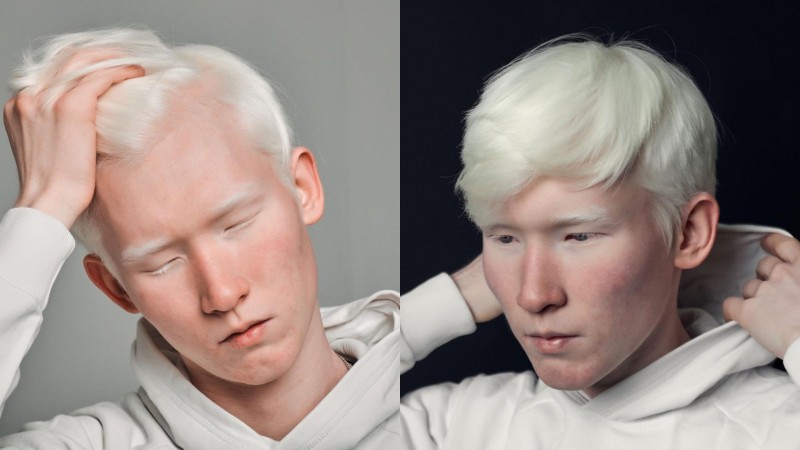 Парень-альбинос из Уральска поразил казахстанцев необычной внешностью