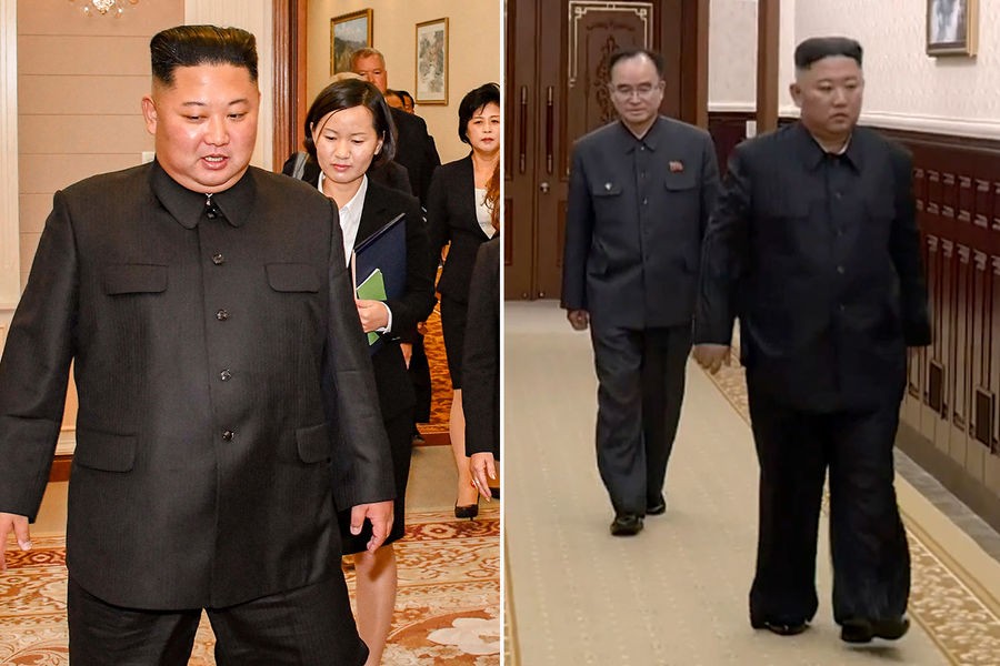 Недуг или ЗОЖ? Ким Чен Ын похудел и шокировал народ переменами во внешности