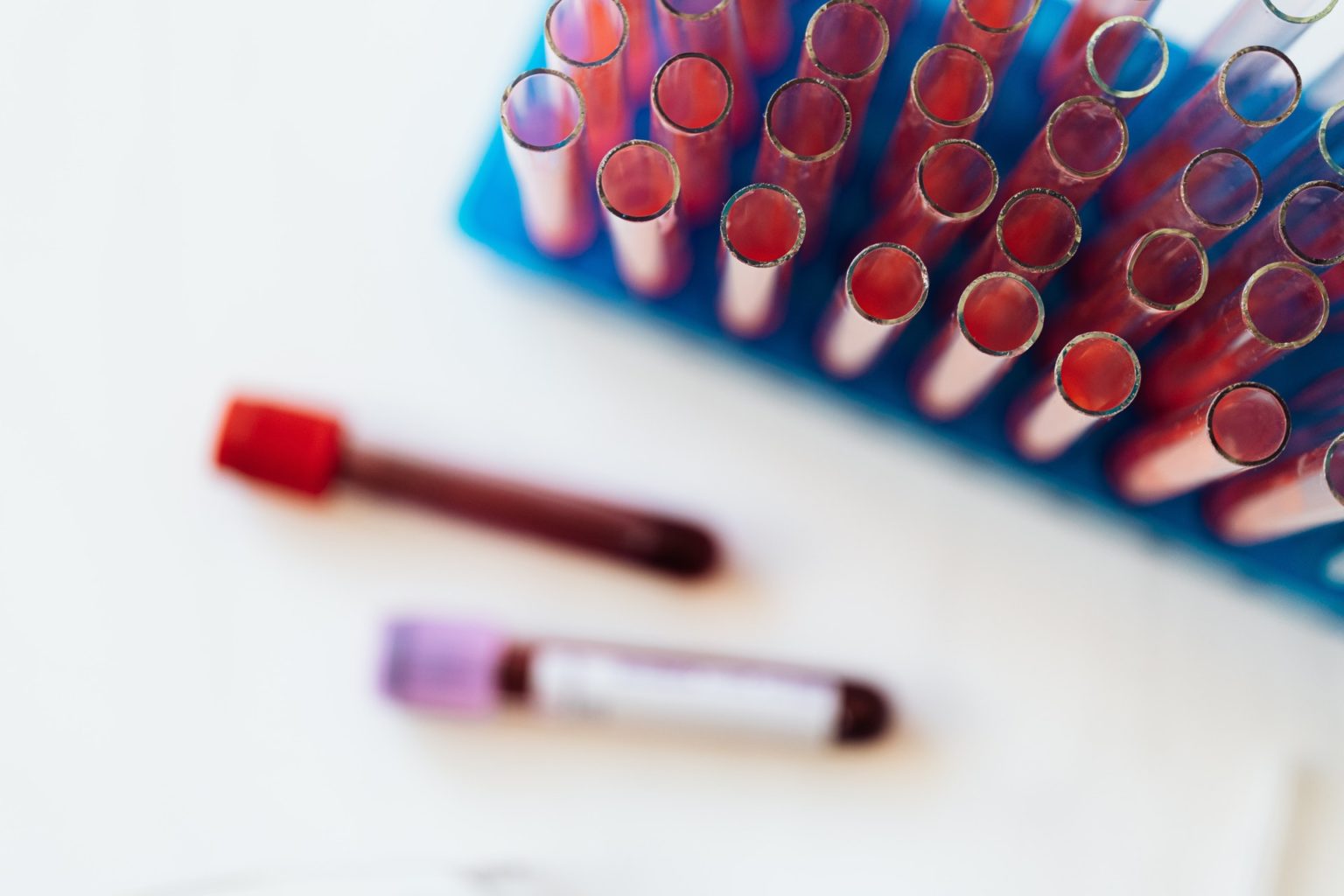 Какая группа крови несет опасность для своих носителей — исследования ученых