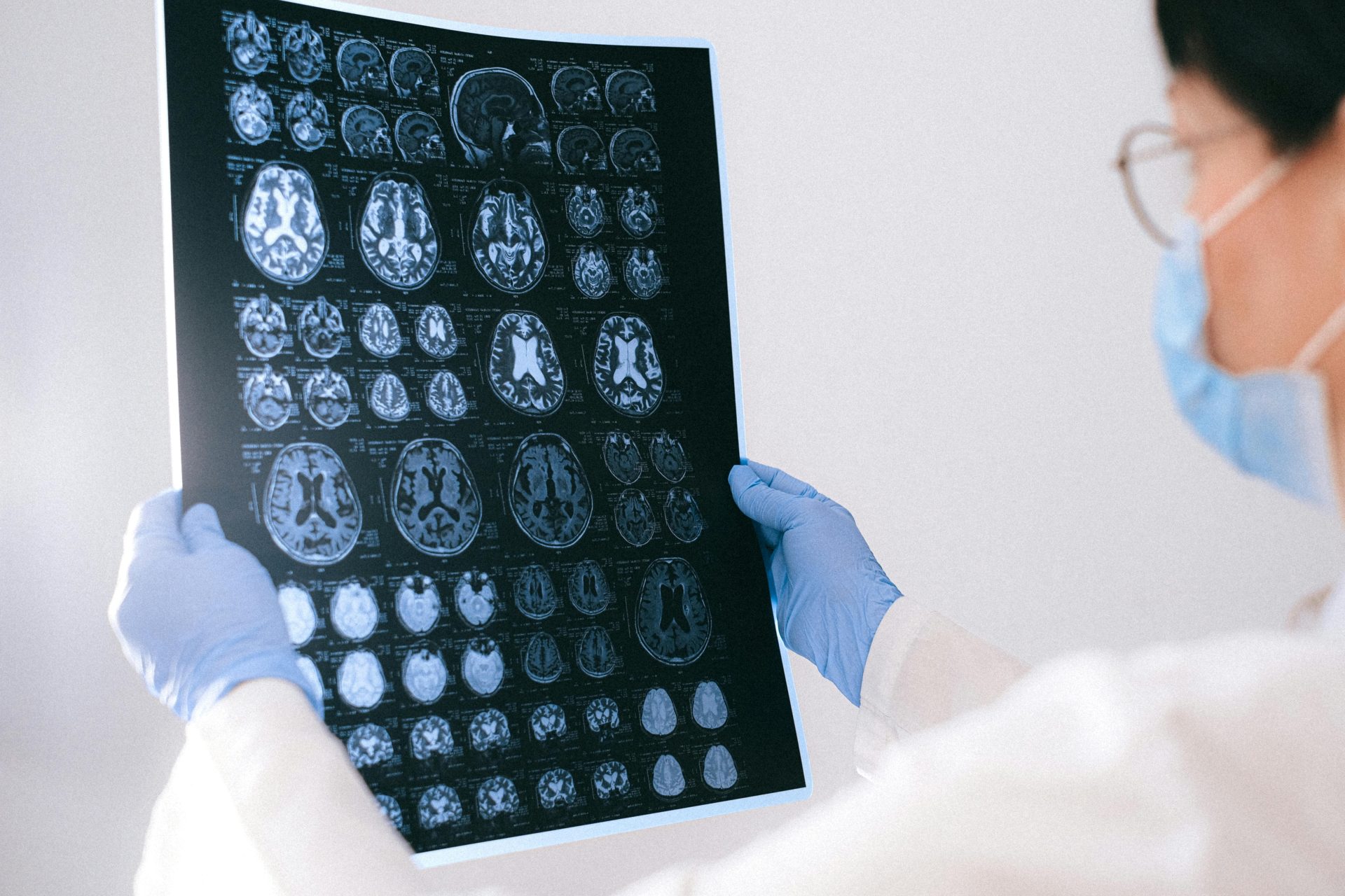 Наш мозг стал крупнее, и это может снизить риск развития деменции