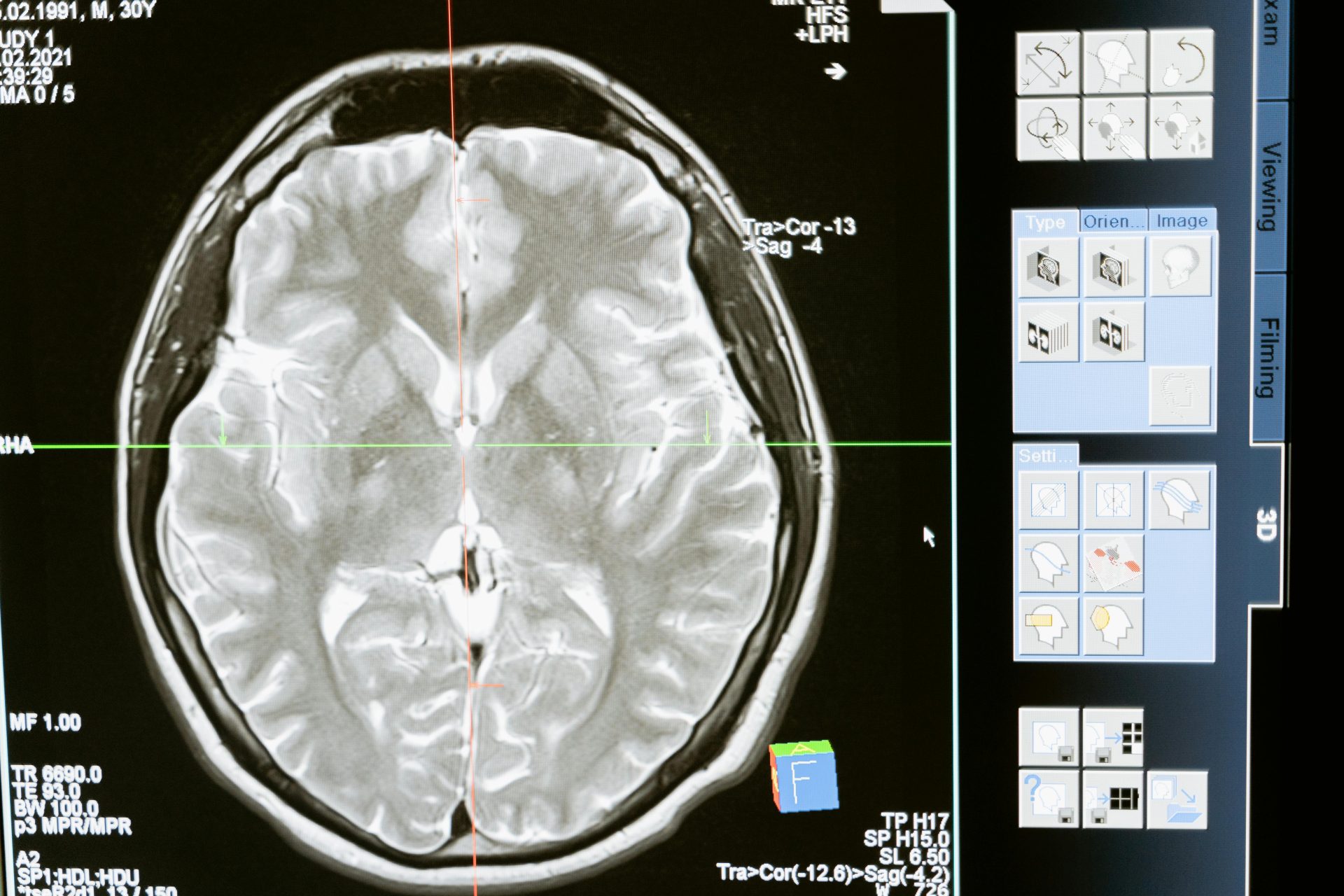 Учёные реконструировали часть коры головного мозга с гигантским разрешением